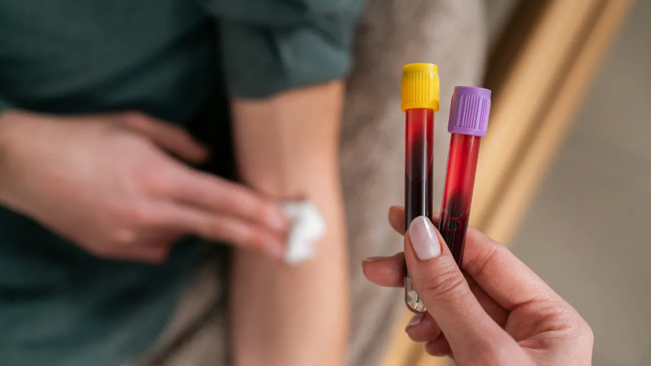 A Simple Blood Test Catches Polyps, Early-Stage Colorectal Cancer