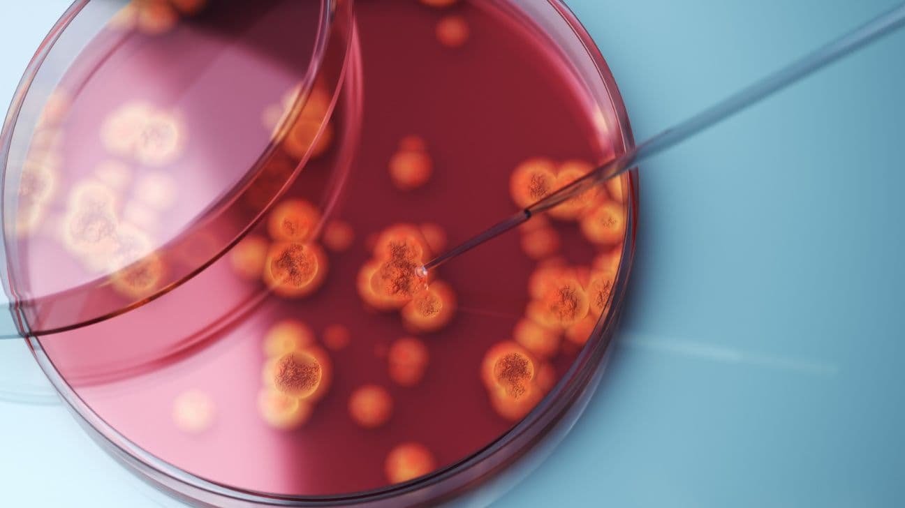 Candida Auris: Drug-Resistant ‘Superbug’ Spreading in 23 States, CDC Says